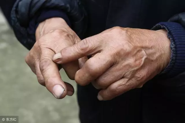 想知道肝臟好不好?敢不敢伸出中指看一看!