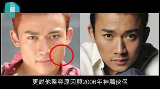 聶遠曾被黃曉明搶戲?10年前怨恨滿滿,失去角色遺憾整形!