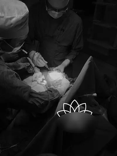 她把偉大縮小了 女郎重新挺胸做人
