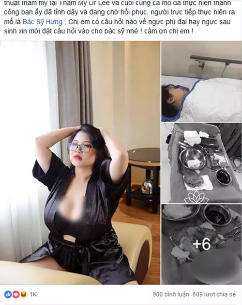 她把偉大縮小了 女郎重新挺胸做人