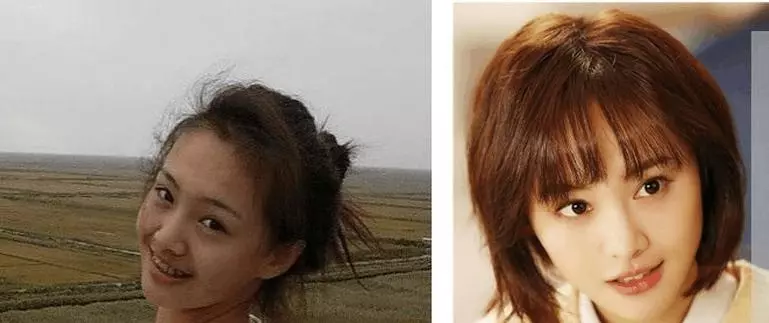 女星沒整牙之前還沒你漂亮,劉濤,胡杏兒辣眼睛,鄭爽卻讓人意外!