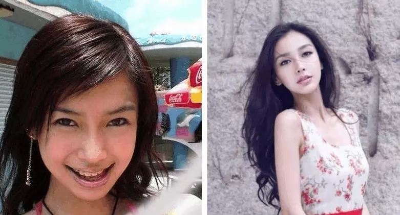 女星沒整牙之前還沒你漂亮,劉濤,胡杏兒辣眼睛,鄭爽卻讓人意外!