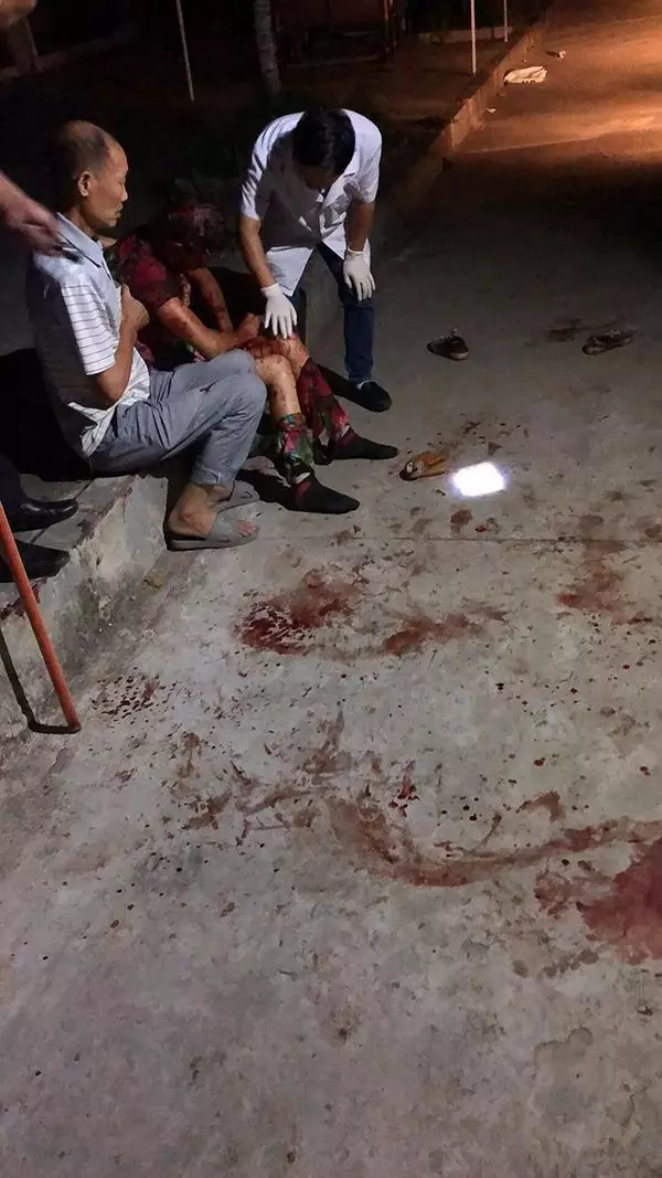 四條惡狗凌晨撕咬拾荒老人:好心人揮棍施救,警方正追查犬主