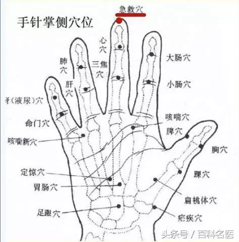 刮手指真的能治療十幾種病嗎?怎麼刮?