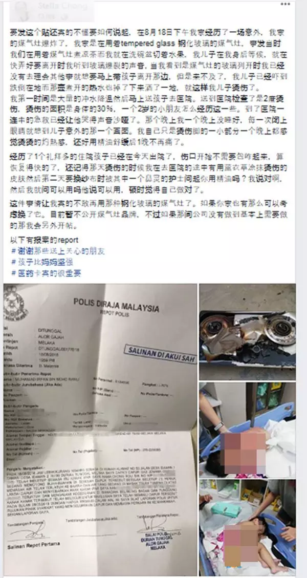 鋼化玻璃液化石油氣爐爆炸 2歲男童慘遭燙傷