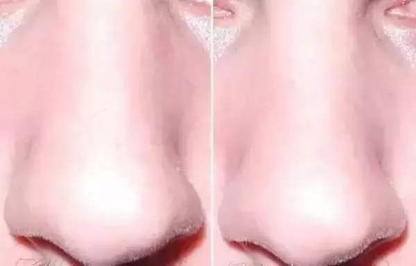 她把牙膏擠到鼻子上就去睡覺!沒想到隔天起床驚呆了!