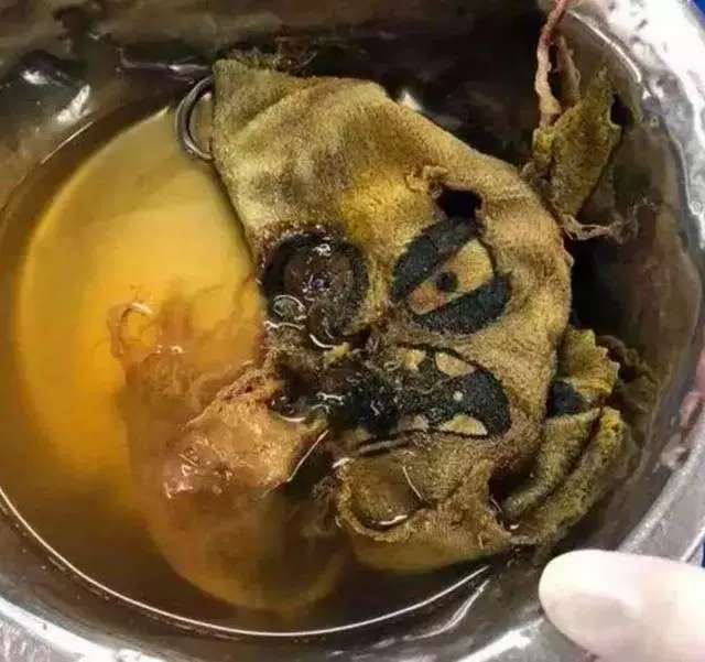 二哈胃中有什麼?醫生十分驚訝,燒烤簽竟從肚皮上冒了出來