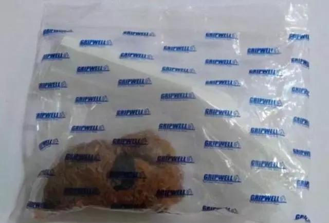 二哈胃中有什麼?醫生十分驚訝,燒烤簽竟從肚皮上冒了出來