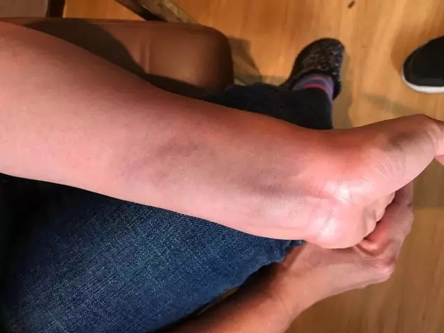 經常拍打手腕一個地方,預防「十大疾病」!
