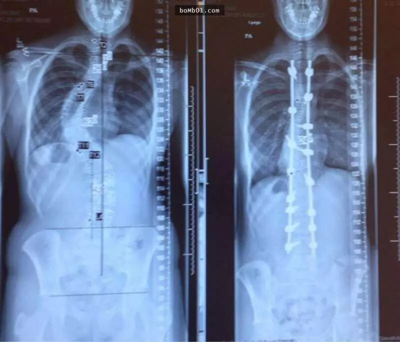 18張讓大家「以從未試過的角度看看知名生活事物另一面」的照片