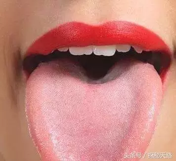 最全中醫舌診食譜來啦!30秒,知全身