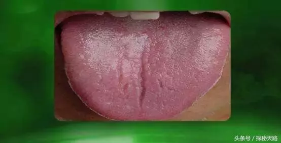 最全中醫舌診食譜來啦!30秒,知全身