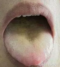 最全中醫舌診食譜來啦!30秒,知全身