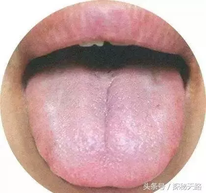 最全中醫舌診食譜來啦!30秒,知全身