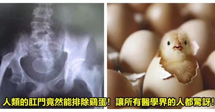 男孩變母鷄!還在三年之內排出了將近一打鷄蛋!
