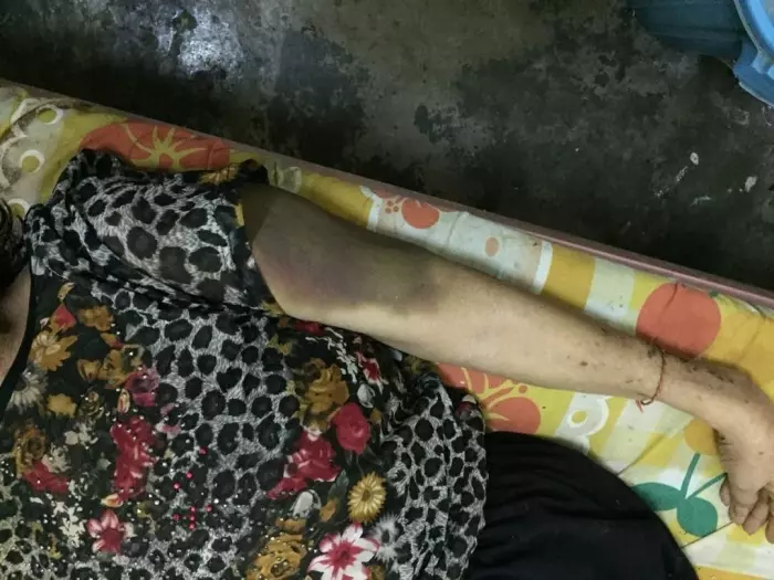 疑不滿勸離婚,惡女婿暴打70歲老岳母致死!