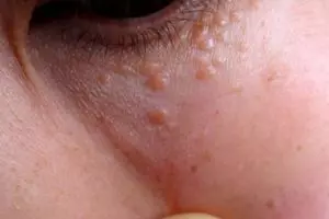 冒雨接孫兒回家!失蹤阿嬤疑被大雨沖走...