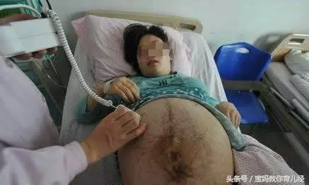 四胞胎孕媽38周遲遲不生,婆婆跪求阻止手術,剖開肚子醫生絕望搖頭!