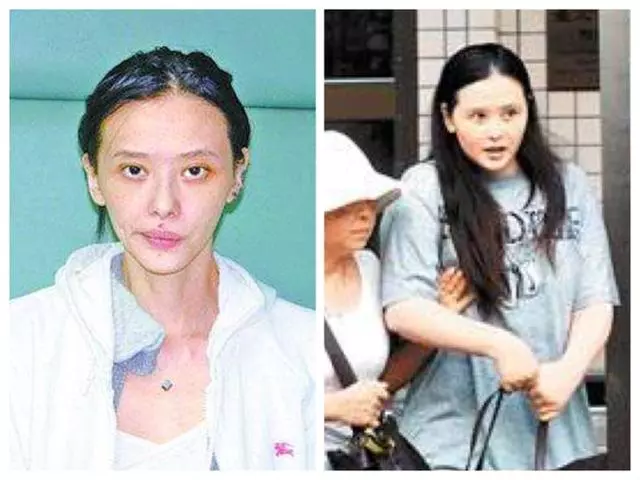 娛樂圈最可惜的女星,小15歲老公嫌她老,蕭淑慎整容復出變腫臉