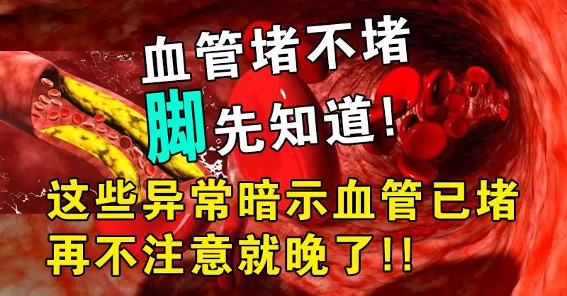 血管堵不堵腳先知道,這些異常暗示血管已堵,再不注意就晚了!!