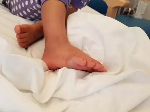 英女童赤腳試新鞋 染細菌致敗血症