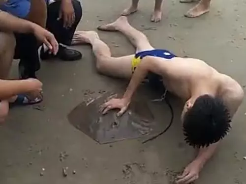 游泳遭魔鬼魚尾刺勾下體 網友看到畫面後忍不住為男子喊疼