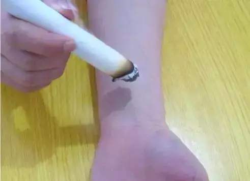 手上有一個「美人穴」,腿上有個「六味地黃丸」