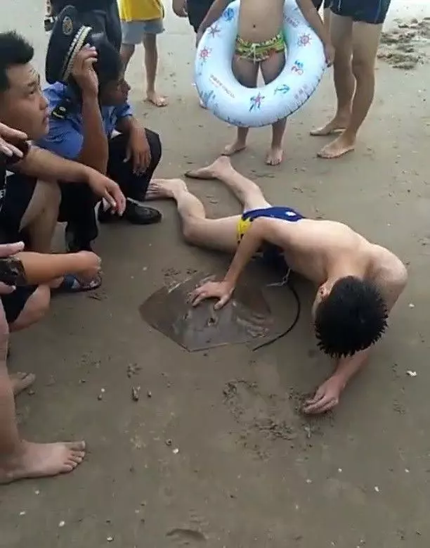 遭魟魚毒刺插小弟弟!醫護人員當機立斷「當場切掉」喀擦一聲... 網:看著都疼 (影)