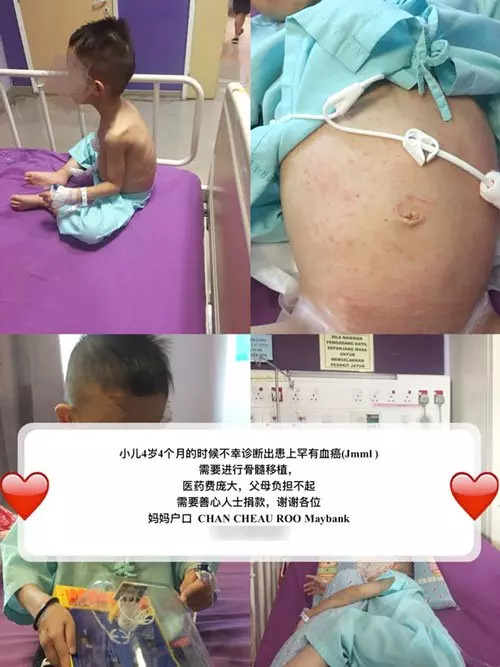 患罕見兒童血癌 小彬彬需10萬移植骨髓
