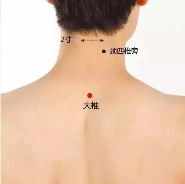 史上最全穴位合集,快速學會如何自治!
