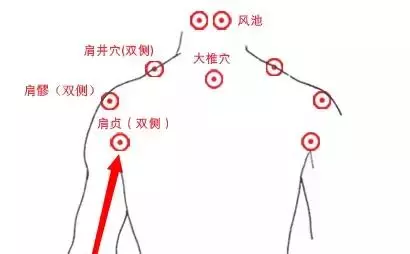 頸椎病、肩周炎……,艾灸這些地方!