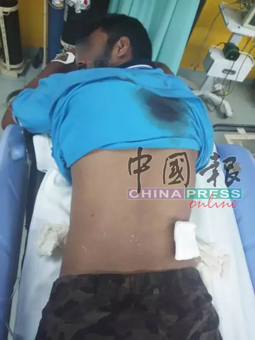 妹妹屢遭騷擾被逼辭工,男子怒火燒!傷15外勞洩恨!