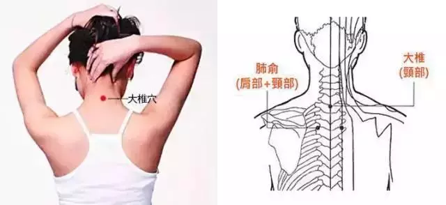 「陽氣」越充足,人體越強壯,養陽氣一定記得——大椎哦!