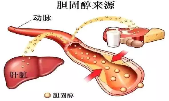 降膽固醇,請收下這份飲食指南 ~