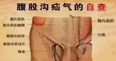 身體出什麼問題按什麼穴,一篇穴位按摩祛病秘籍!