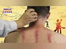 一個星期刮一遍,經絡通暢百病消