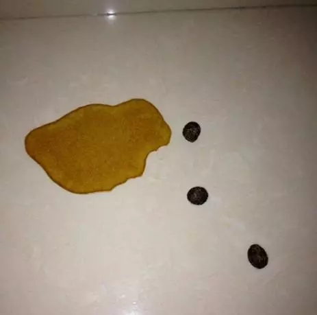 肝不好的人,上廁所會有這4種表現,占了一個,都要抓緊養肝了!