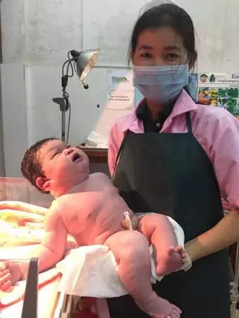 婦女自然產 誕6.8公斤巨嬰