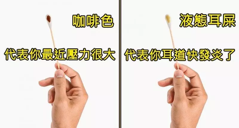 你最近挖完耳朵的「棉花棒是什麼顏色」?診斷你的身體到底出了什麼問題