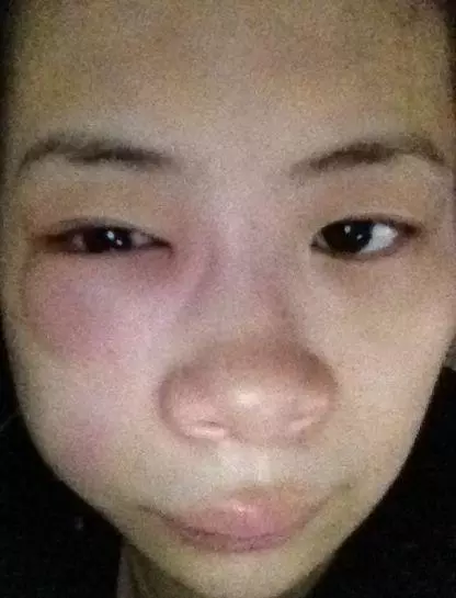 老婆提十斤雞蛋去看小姑子,回來看到老婆的臉,我把我媽趕了出去
