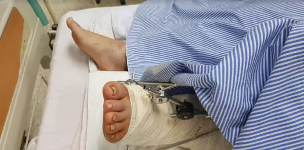 車禍後長巴飄汽油味 獅城一家四口砸窗逃命