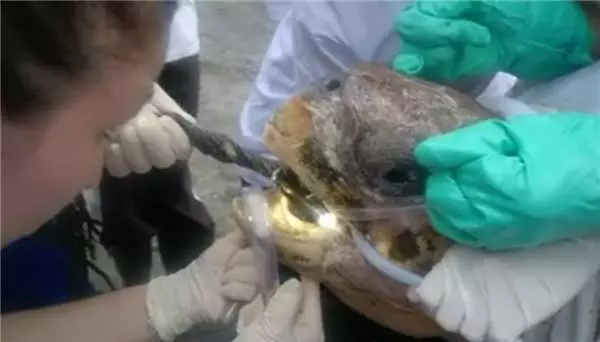 海龜忍著痛「嘴巴被撬開」!救援志工用力拉出一大條...網友心痛:都是人類害了牠QQ