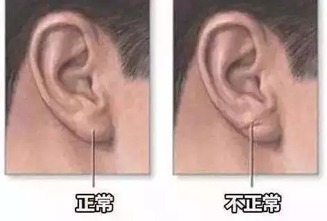 身體是否健康,看看面部就知道!中醫教你30秒自測!