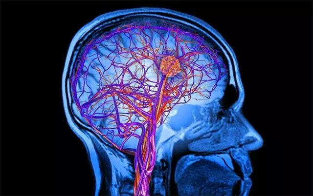 大腦血管好不好,「抬雙臂」可能會知道,不論男女,不妨自測一下