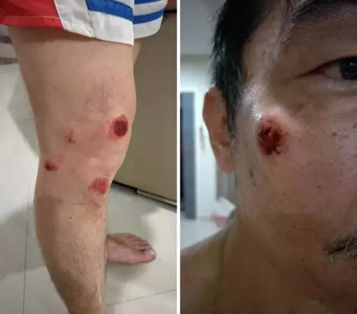 【馬來西亞】新山撞人承諾賠償卻半路落跑?新加坡車主被網友肉搜!