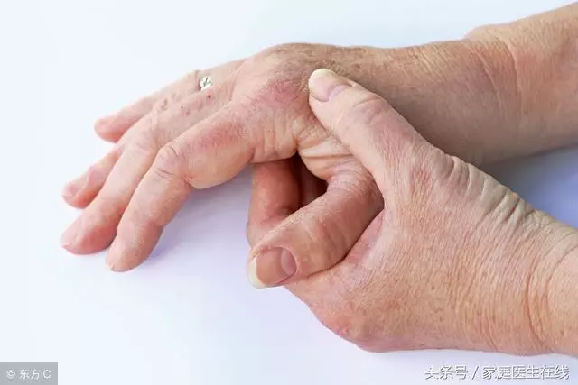 關節炎和痛風傻傻分不清楚?認清5個不同,就不會再混淆了