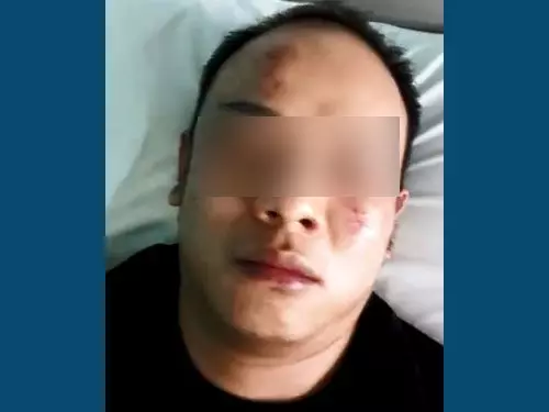 友人欠債逃 男子遭15大耳窿圍毆 | 中國報 China Press
