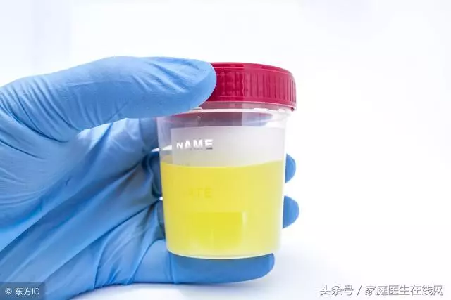 尿毒症就喜歡找這4種人,不提前預防,醫生也無力幫你