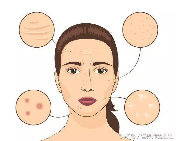入秋後,出現6大症狀,說明體內毒素多,做好「5個字」,促排毒
