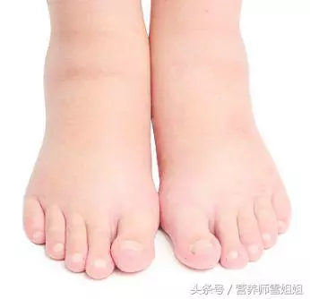 入秋後,出現6大症狀,說明體內毒素多,做好「5個字」,促排毒
